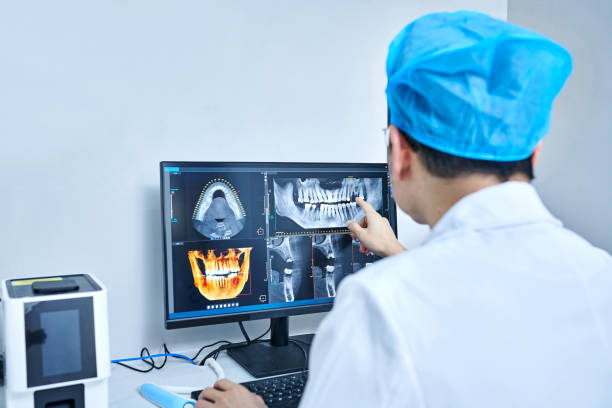 Best Broken or Chipped Tooth Repair in Mec, CA